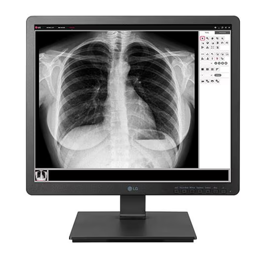 1.3 MP Clinical Review Monitor